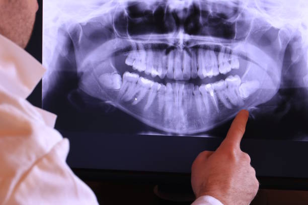 Best Weekend Emergency Dentist in Pinehurst, MA