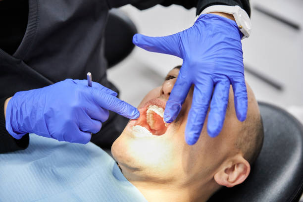 Best Broken or Cracked Tooth Emergency Dentist in Pinehurst, MA