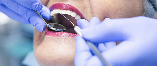 Best Emergency Dentist for Lost Fillings or Crowns in Pinehurst, MA